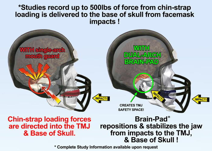 Brain-Pad-helmets-chin-cup-loading.jpg - 291.78 kB